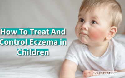 How To Treat And Control Eczema in Children