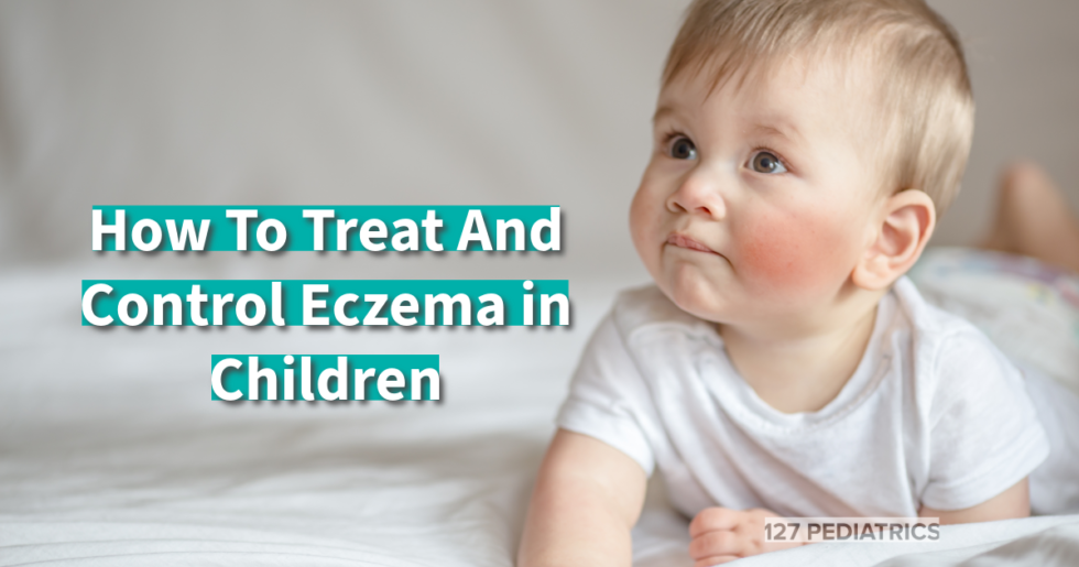 How To Treat And Control Eczema in Children - 127 Pediatrics