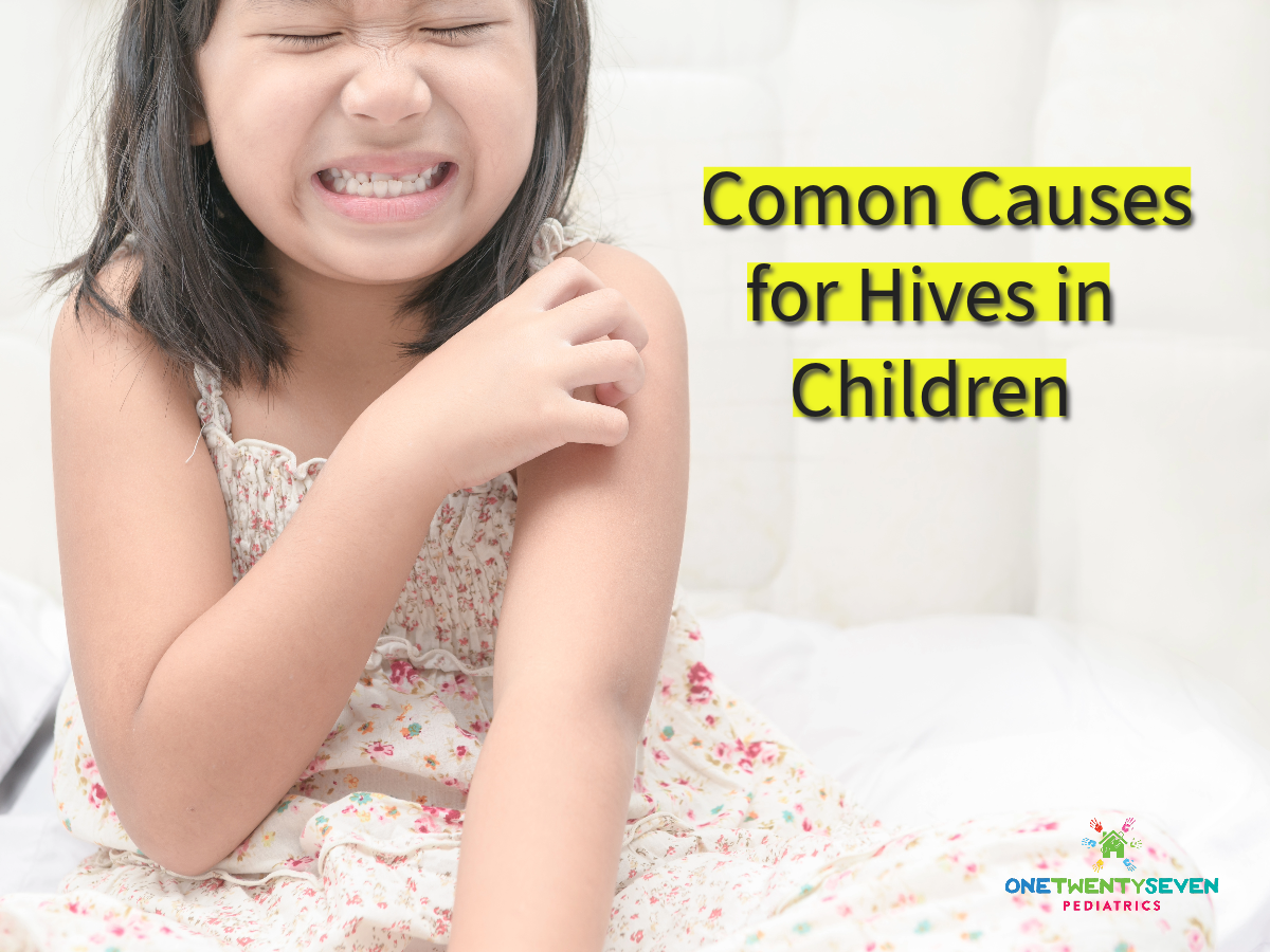 common causes for hives in children 