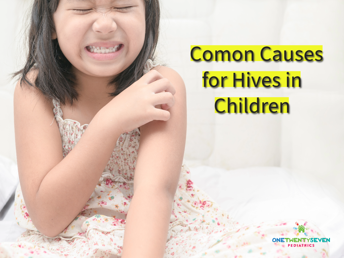 what-causes-hives-in-kids-out-of-nowhere-127-pediatrics