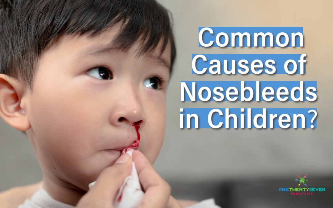 common causes of nosebleeds in children