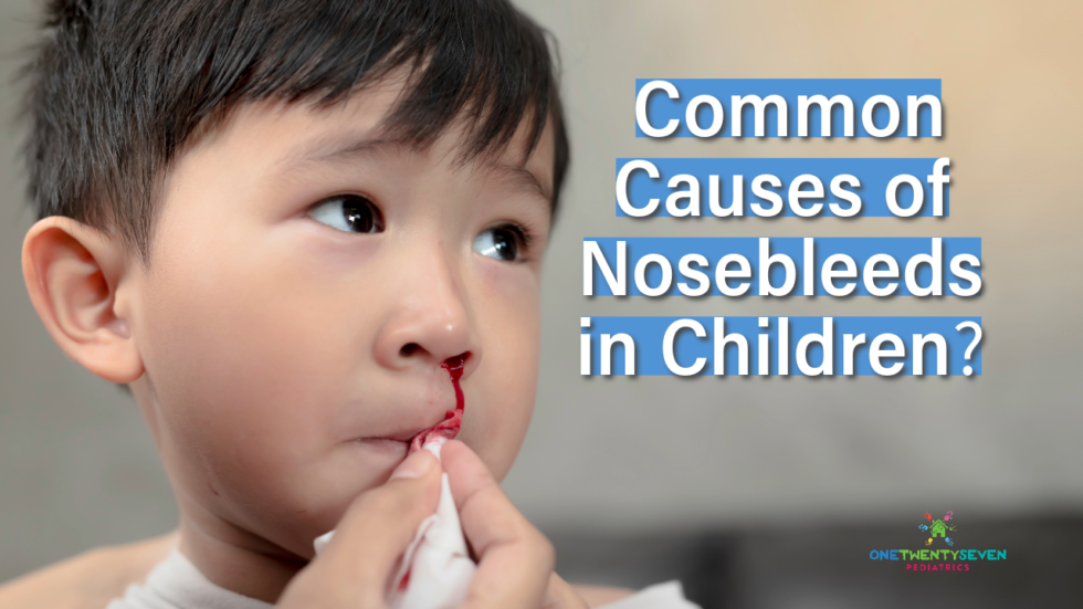 Common Causes Of Nosebleeds In Children - 127 Pediatrics